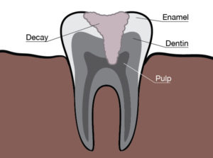 Gurnee Dentist 