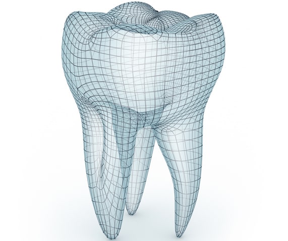 Dental implant computer model