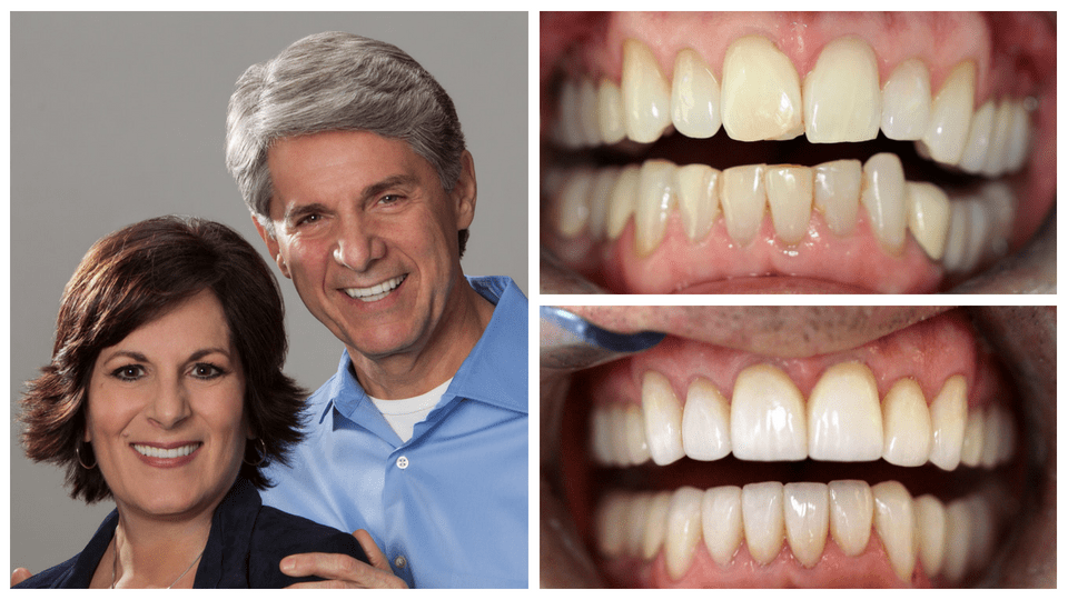 Elderly man smiling and hugging his dark-haired wife with his before and after images next to him
