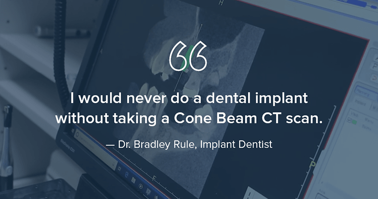 "I would never do a dental implant without taking a Cone Beam CT scan." - Dr. Bradley Rule, Implant Dentist